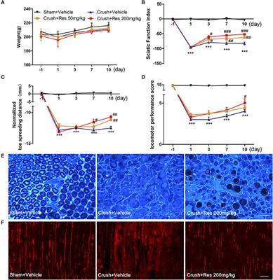 Resveratrol Promotes Nerve Regeneration via Activation of p300 Acetyltransferase-Mediated VEGF Signaling in a Rat Model of Sciatic Nerve Crush Injury